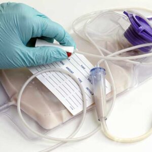 Nutrition support in critically ill adult patients (Enteral)