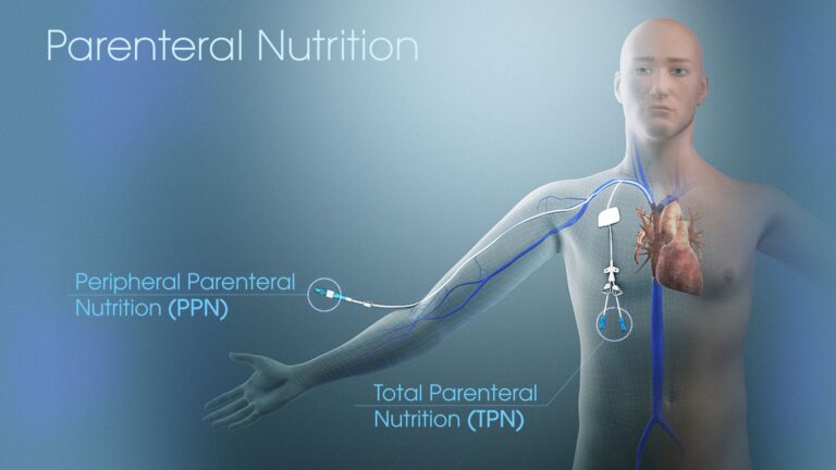 Parenteral Nutrition